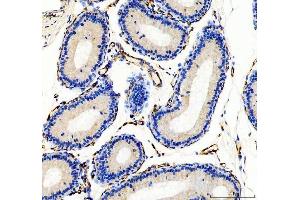 IHC analysis of CD31 using anti-CD31 antibody (ABIN5692990).
