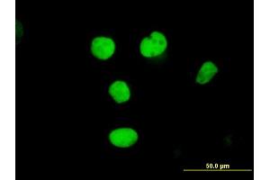 Immunofluorescence of purified MaxPab antibody to RFC2 on HeLa cell.