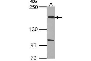 WB Image Sample (30 ug of whole cell lysate) A: H1299 5% SDS PAGE EVC2 antibody antibody diluted at 1:1000 (EVC2 Antikörper  (C-Term))