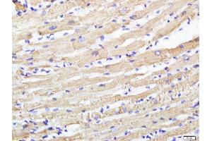 Paraformaldehyde-fixed, paraffin embedded rat heart, Antigen retrieval by boiling in sodium citrate buffer (pH6) for 15min, Block endogenous peroxidase by 3% hydrogen peroxide for 30 minutes, Blocking buffer (normal goat serum) at 37°C for 20min, Antibody incubation with CABC1 Polyclonal Antibody, Unconjugated  at 1:500 overnight at 4°C, followed by a conjugated secondary and DAB staining. (COQ8A Antikörper  (AA 501-647))