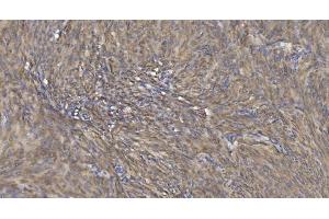 IHC analysis of Alpha B Crystallin/CRYAB using anti-Alpha B Crystallin/CRYAB antibody (ABIN7601209). (CRYAB Antikörper  (AA 30-151))