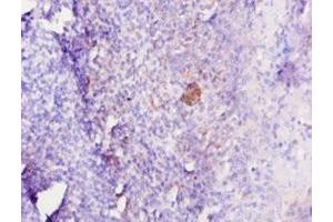 Immunohistochemistry of paraffin-embedded human tonsil tissue using ABIN7179323 at dilution of 1:10 (IL12B Antikörper  (AA 23-327))