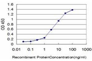 Detection limit for recombinant GST tagged KIAA2002 is approximately 0. (PEAK1 Antikörper  (AA 1151-1250))
