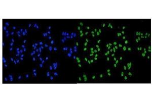 IF analysis of MCM2 using anti-MCM2 antibody (ABIN7601594). (MCM2 Antikörper  (AA 393-850))