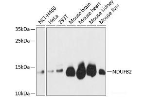 Western blot analysis of extracts of various cell lines using NDUFB2 Polyclonal Antibody at dilution of 1:3000. (NDUFB2 Antikörper)