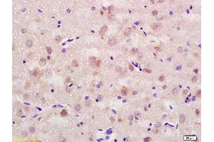 Formalin-fixed and paraffin embedded rat brain labeled with Rabbit Anti CD56/NCAM1 Polyclonal Antibody, Unconjugated (ABIN728398) at 1:200 followed by conjugation to the secondary antibody and DAB staining (CD56 Antikörper  (AA 621-720))