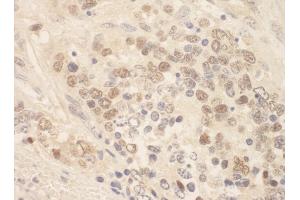 Immunohistochemistry (IHC) image for anti-Zinc Finger E-Box Binding Homeobox 2 (ZEB2) (AA 750-800) antibody (ABIN7448878) (ZEB2 Antikörper  (AA 750-800))