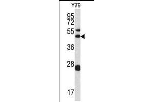 Western blot analysis of ARPC1A antibody in Y79 cell line lysates (35ug/lane) (ARPC1A Antikörper  (AA 157-184))