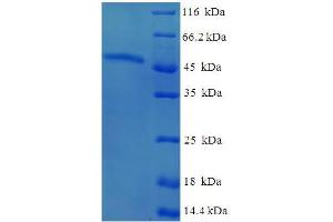AKTIP Protein (AA 1-292, full length) (His-SUMO Tag)