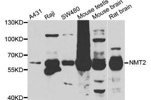 Western blot analysis of extracts of various cell lines, using NMT2 antibody. (NMT2 Antikörper)