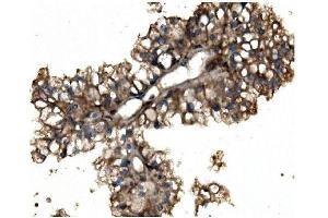 IHC analysis of Aconitase 1/ACO1 using anti-Aconitase 1/ACO1 antibody (ABIN7598988).