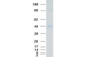 Western Blotting (WB) image for Mitogen-Activated Protein Kinase 9 (MAPK9) protein (Myc-DYKDDDDK Tag) (ABIN2725449)