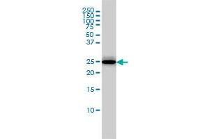 RGS2 monoclonal antibody (M01), clone 4C4 Western Blot analysis of RGS2 expression in MCF-7 . (RGS2 Antikörper  (AA 111-211))