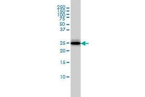 RGS2 monoclonal antibody (M01), clone 4C4 Western Blot analysis of RGS2 expression in MCF-7 .
