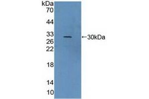 Detection of Recombinant vWA2, Human using Polyclonal Antibody to Von Willebrand Factor A Domain Containing Protein 2 (vWA2) (VWA2 Antikörper  (AA 457-708))