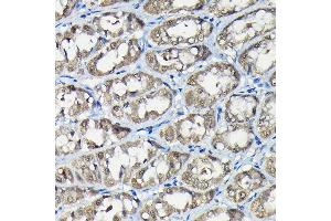 Immunohistochemistry of paraffin-embedded rat stomach using USP5 Rabbit pAb (ABIN1683231, ABIN3018687, ABIN3018688 and ABIN6220542) at dilution of 1:100 (40x lens). (USP5 Antikörper  (AA 1-280))