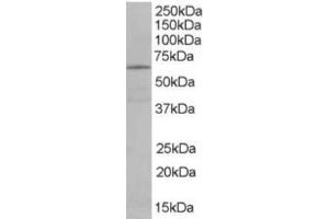 Western Blotting (WB) image for anti-EH-Domain Containing 2 (EHD2) (C-Term) antibody (ABIN2465640) (EHD2 Antikörper  (C-Term))