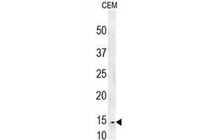 CRCT1 Antibody (N-term) western blot analysis in CEM cell line lysates (35µg/lane). (CRCT1 Antikörper  (N-Term))