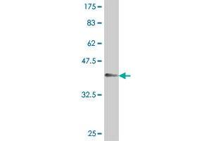 Western Blot detection against Immunogen (37. (CLPTM1 Antikörper  (AA 151-251))