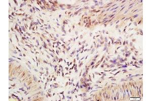 Formalin-fixed and paraffin embedded mouse intestine labeled with Anti-IRF2 Polyclonal Antibody, Unconjugated  at 1:200 followed by conjugation to the secondary antibody and DAB staining (IRF2 Antikörper  (AA 81-180))