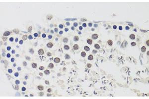 Immunohistochemistry of paraffin-embedded Rat testis using CCNE2 Polyclonal Antibody at dilution of 1:100 (40x lens). (Cyclin E2 Antikörper)