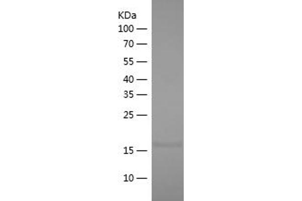 IL1F9 Protein (AA 13-164) (His tag)