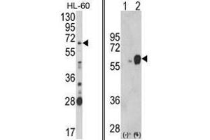 (LEFT) Western blot analysis of ARSB Antibody (Center) in HL-60 cell line lysates (35ug/lane). (Arylsulfatase B Antikörper  (Middle Region))