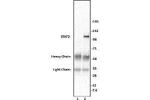 STAT2 antibody (pAb) tested by Immunoprecipitation. (STAT2 Antikörper  (C-Term))
