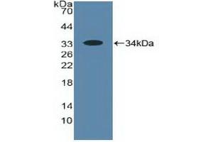 Detection of Recombinant ALOX5, Human using Polyclonal Antibody to 5-Lipoxygenase (5-LO) (ALOX5 Antikörper  (AA 461-671))