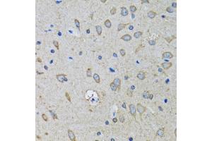 Immunohistochemistry of paraffin-embedded mouse brain using SSBP1 antibody (ABIN5974202) at dilution of 1/100 (40x lens). (SSBP1 Antikörper)
