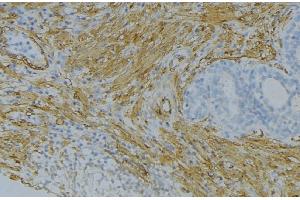 ABIN6274666 at 1/100 staining Human uterus tissue by IHC-P. (FGF18 Antikörper  (Internal Region))