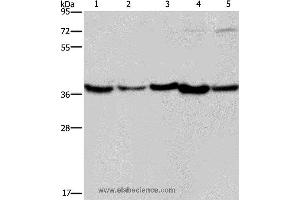 Western blot analysis of Human fetal liver, mouse skeletal muscle and heart tissue, Hela and Jurkat cell, using DNAJB4 Polyclonal Antibody at dilution of 1:200 (DNAJB4 Antikörper)