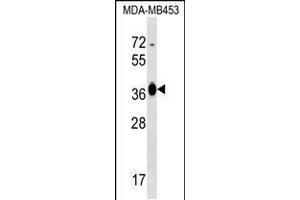 Western blot analysis in MDA-MB453 cell line lysates (35ug/lane). (GFOD2 Antikörper  (N-Term))