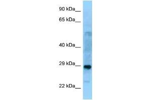 WB Suggested Anti-PROSC Antibody Titration: 1. (PROSC Antikörper  (C-Term))