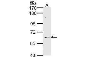WB Image Sample (30 ug of whole cell lysate) A: H1299 7. (ADCK1 Antikörper)