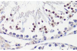 Immunohistochemistry of paraffin-embedded Rat testis using HFM1 Polyclonal Antibody at dilution of 1:100 (40x lens). (HFM1 Antikörper)