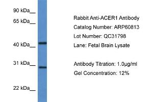 Western Blotting (WB) image for anti-Alkaline Ceramidase 1 (ACER1) (C-Term) antibody (ABIN2788592) (ACER1 Antikörper  (C-Term))