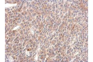 Immunohistochemistry (IHC) image for anti-Protein tyrosine Phosphatase, Non-Receptor Type 11 (PTPN11) (C-Term) antibody (ABIN2854914)