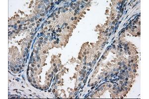 Immunohistochemical staining of paraffin-embedded Human colon tissue using anti-PIM2 mouse monoclonal antibody. (PIM2 Antikörper)
