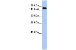 UBE3A antibody used at 1 ug/ml to detect target protein.