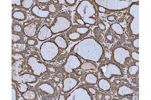 IHC analysis of MTHFD1 using anti-MTHFD1 antibody (ABIN7600631).