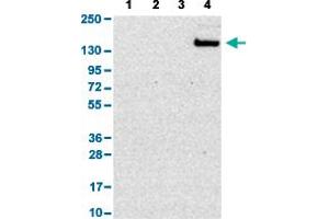 Western Blot analysis with SIGLEC1 polyclonal antibody . (Sialoadhesin/CD169 Antikörper  (AA 1425-1510))