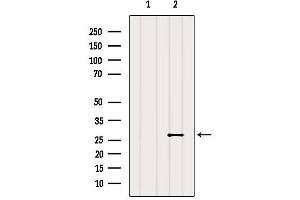 Western blot analysis of extracts from Hela, using RAB20 Antibody.
