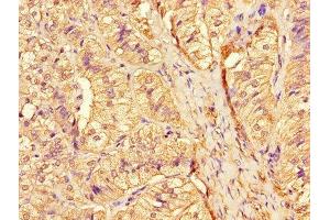 Immunohistochemistry of paraffin-embedded human adrenal gland tissue using ABIN7158780 at dilution of 1:100 (CTSA Antikörper  (AA 30-327))