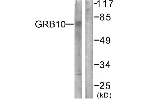 Immunohistochemistry analysis of paraffin-embedded human brain tissue using GRB10 (Ab-67) antibody. (GRB10 Antikörper)