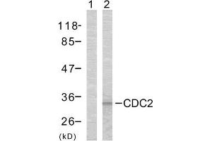 Western blot analysis of the extracts from COLO cells using CDC2 (Ab-161) antibody (E021152). (CDK1 Antikörper)