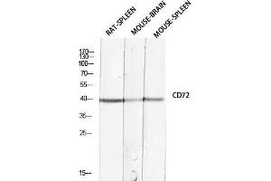 Western Blot (WB) analysis of Rat Spleen Mouse Brain Mouse Spleen lysis using CD72 antibody. (CD72 Antikörper)