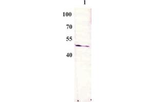 anti-Bovine Papilloma Virus 1 E2 (BPV-1 E2) (AA 197-208) antibody