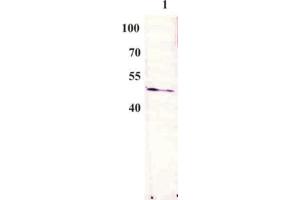Western Blot testing of anti-BPV E2 monoclonal antibody (3F12). (Bovine Papilloma Virus 1 E2 (BPV-1 E2) (AA 197-208) Antikörper)