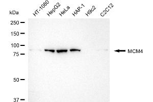 anti-Minichromosome Maintenance Deficient 4 (MCM4) antibody